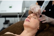 Microdermabrasion